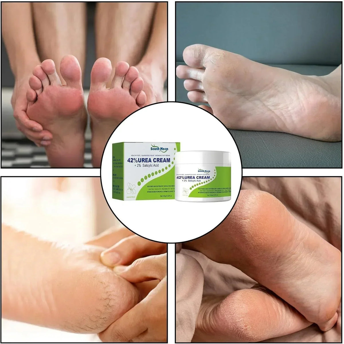 South Moon - 42% Urea Cream + 2% Salicylic Acid (Original)